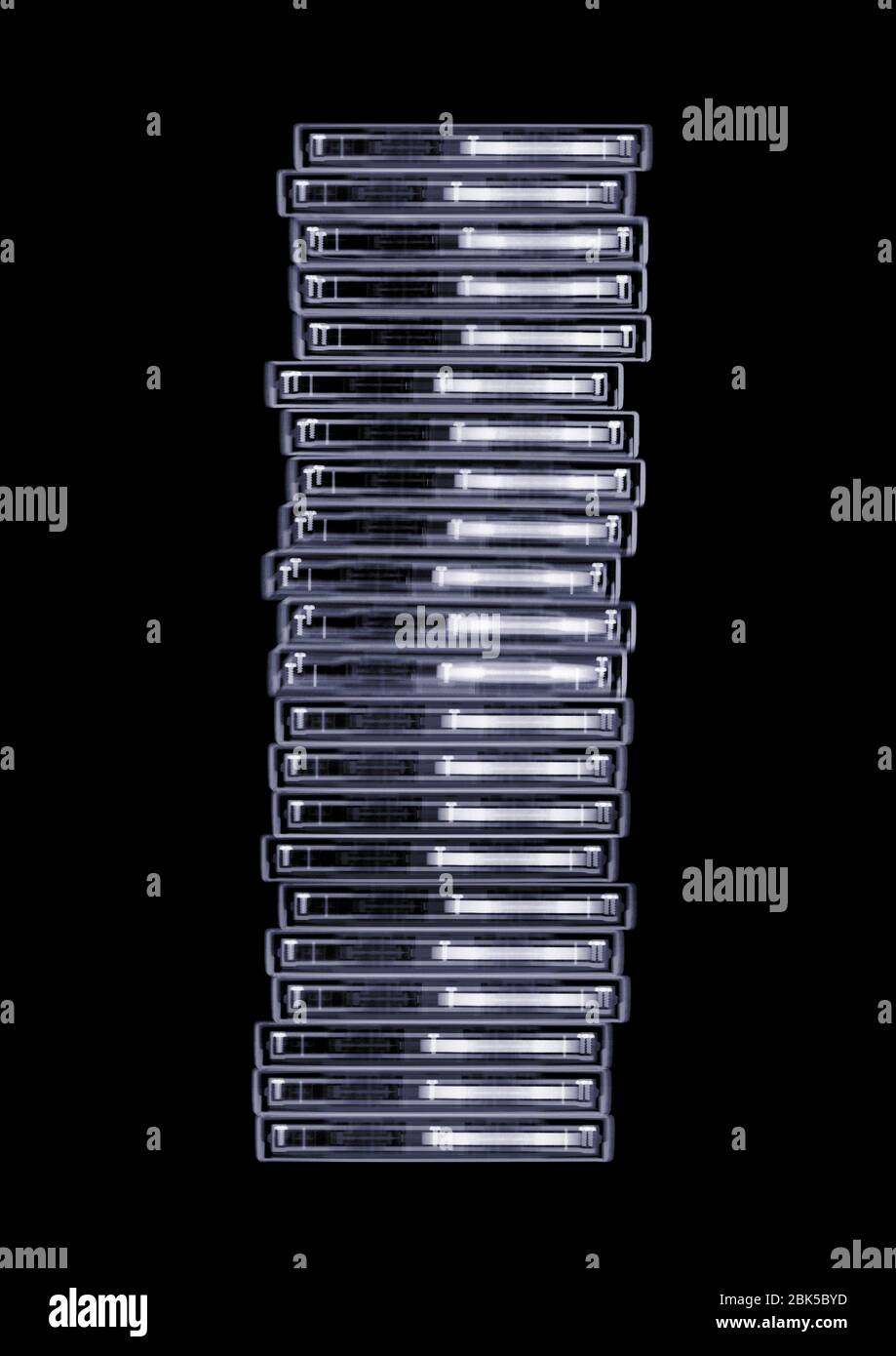 Stack di custodie per supporti, raggi X. Foto Stock