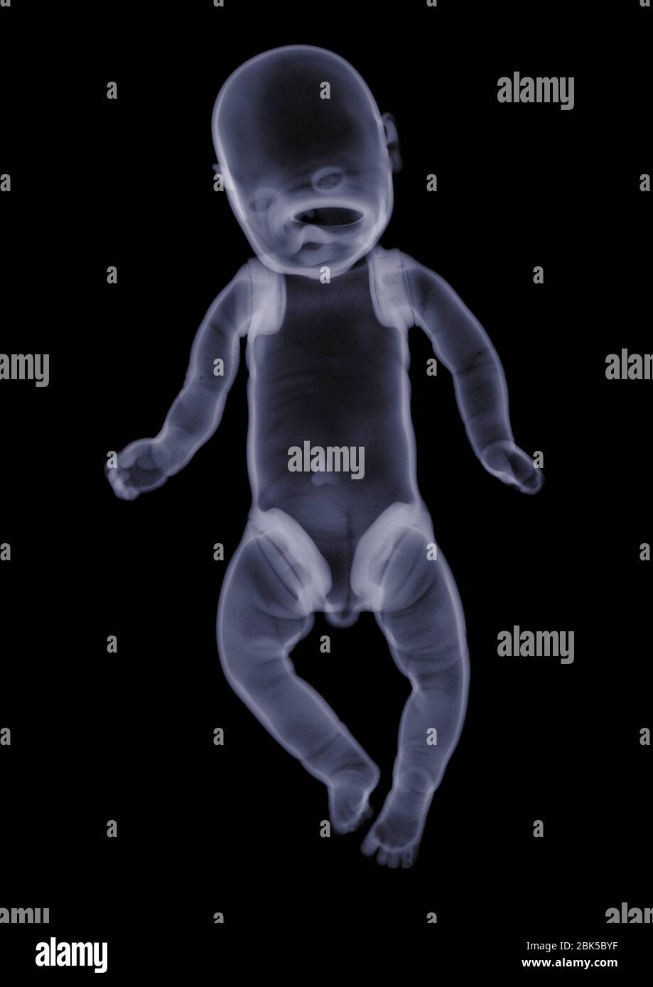 Bambola, raggi X. Foto Stock