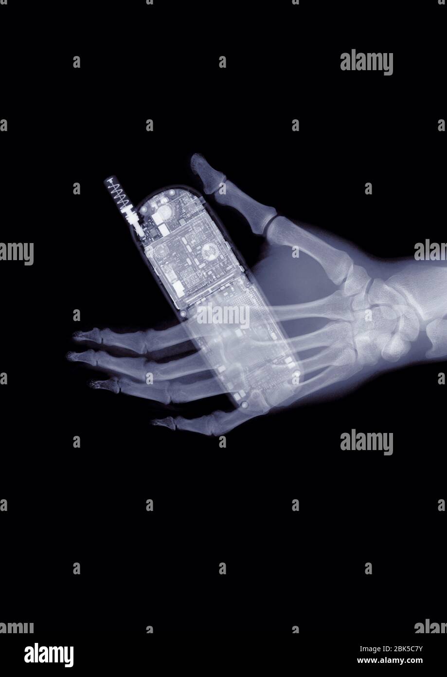 Mano con un telefono cellulare, raggi X. Foto Stock