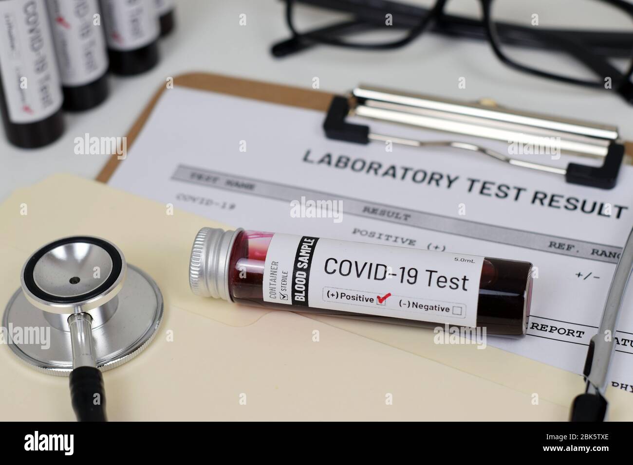 Immagine illustrativa del risultato del test Covid-19 (Coronavirus) con provetta e stampa. Foto Stock