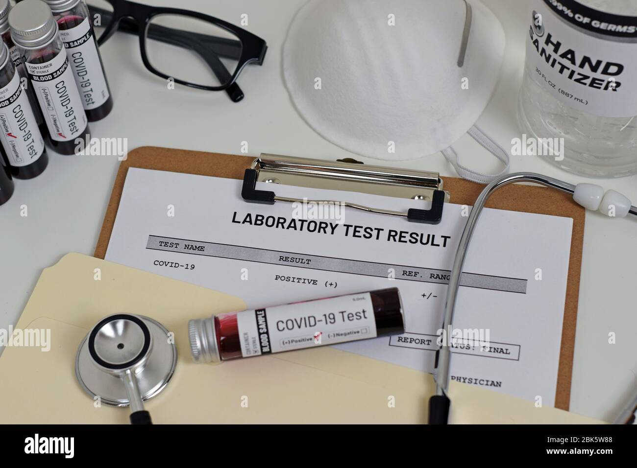 Immagine illustrativa del risultato del test Covid-19 (Coronavirus) con provetta e stampa. Foto Stock