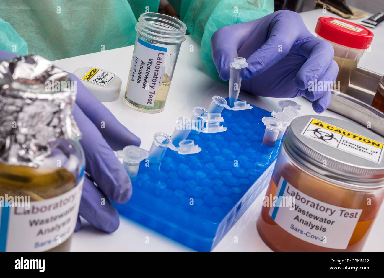Analisi scientifica del campione di acque reflue in laboratorio, indagine di possibile contaminazione da parte di Sars-Cov-2 nell'uomo, immagine concettuale Foto Stock
