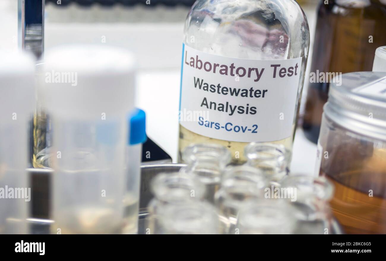 Campioni di acque reflue, analisi del virus sars-cov-2 in pazienti infettati da coronavirus umano 229E, immagine concettuale Foto Stock