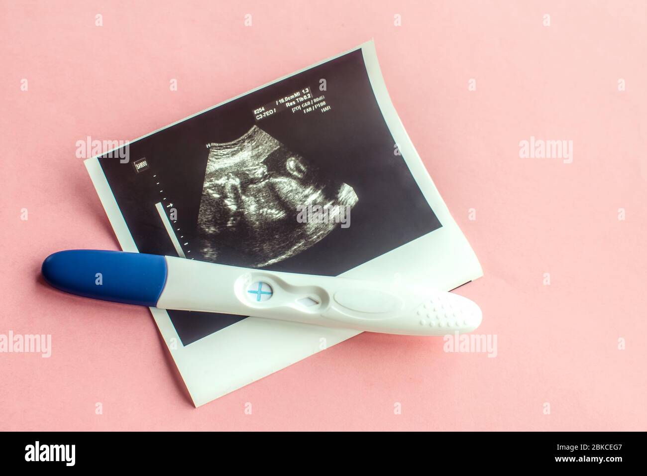 Ecografia con test di gravidanza positivo su fondo rosa. Foto Stock