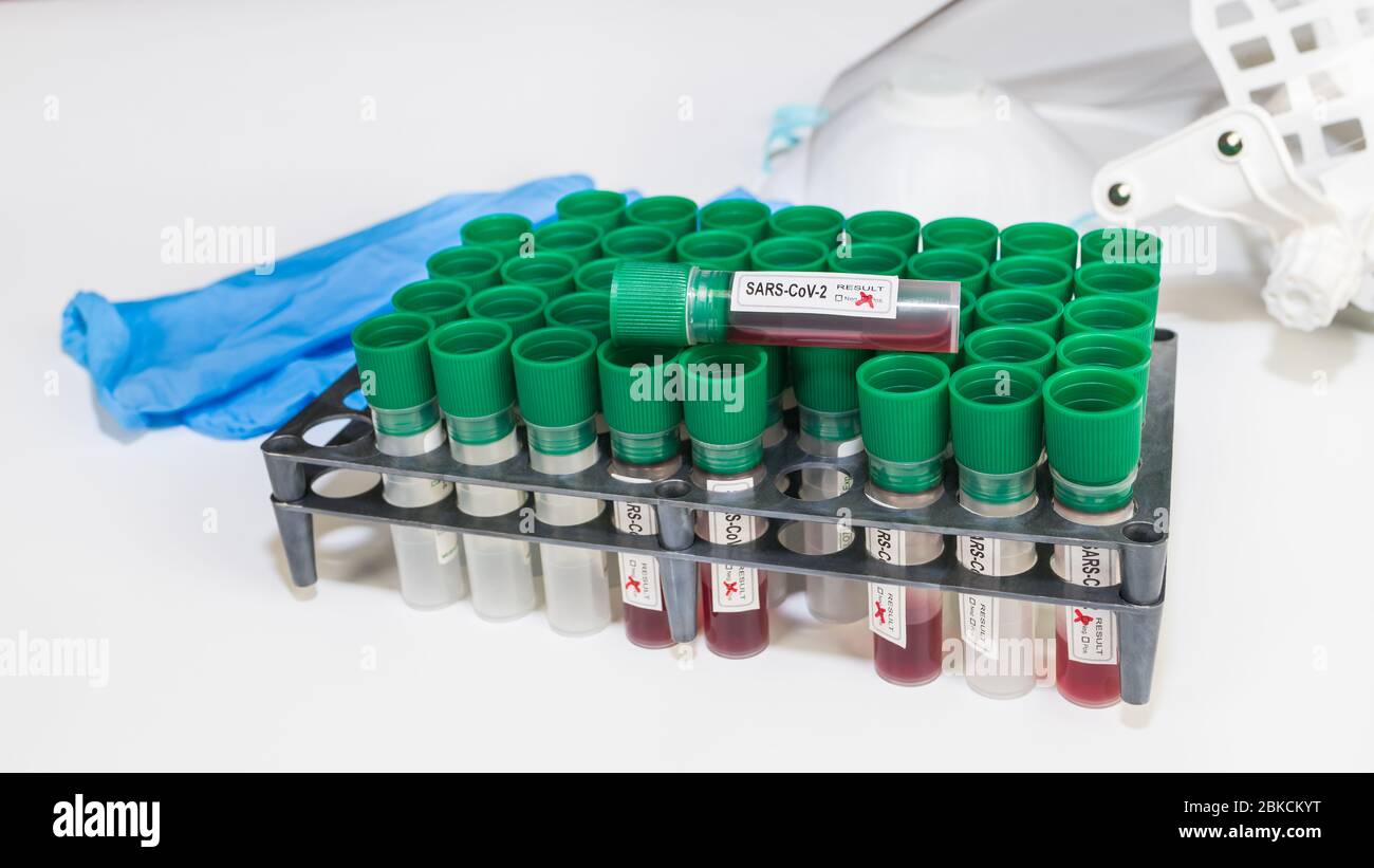 Coronavirus pandemico. Provette per campioni SARS-cov-2 in rack. Dispositivi di protezione. Focolaio COVID-19. Fiale per uso medico, guanti blu, respiratore e protezione. Foto Stock