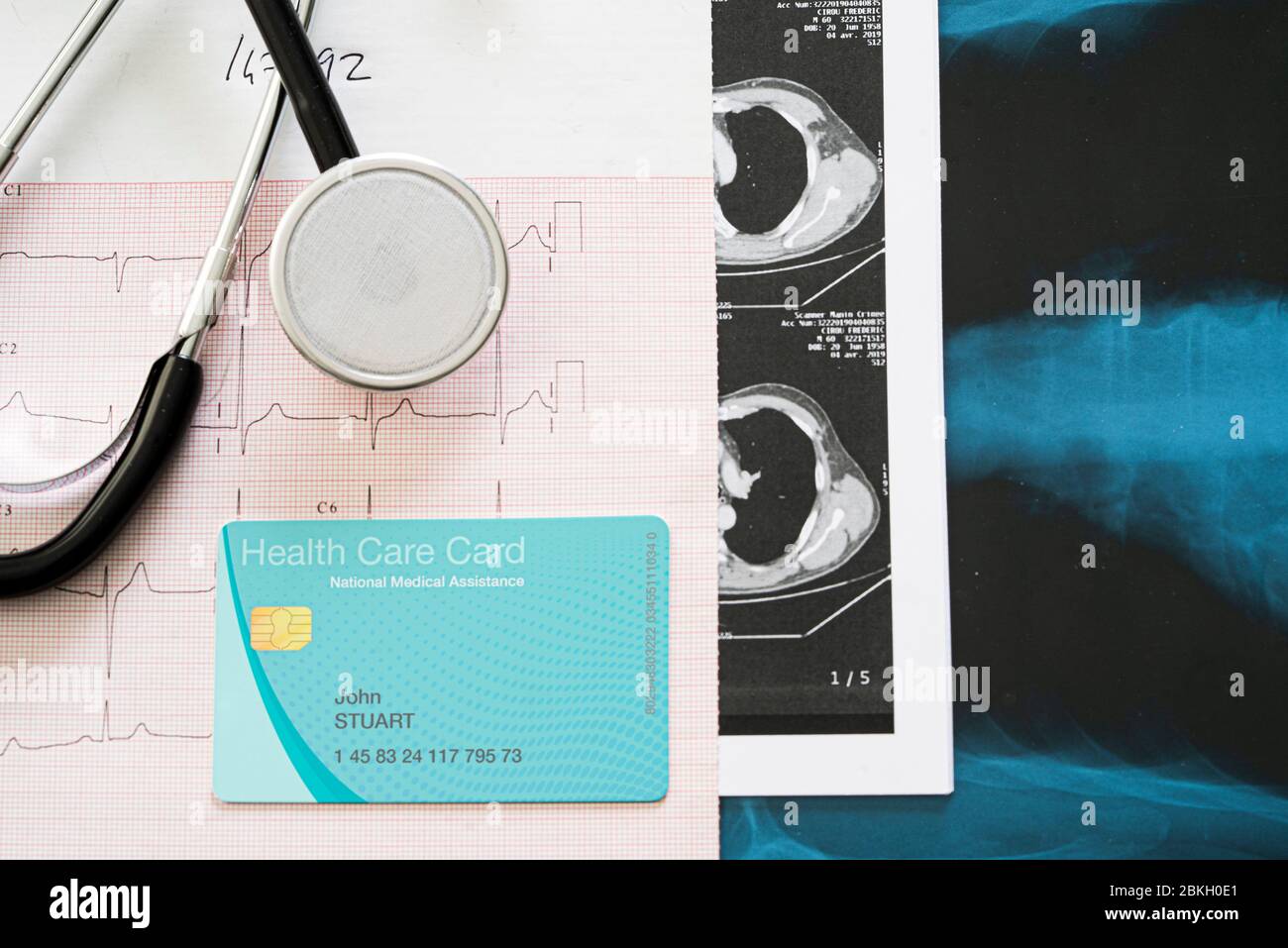 Primo piano dello stetoscopio e della scheda di assistenza sanitaria sui rapporti medici Foto Stock