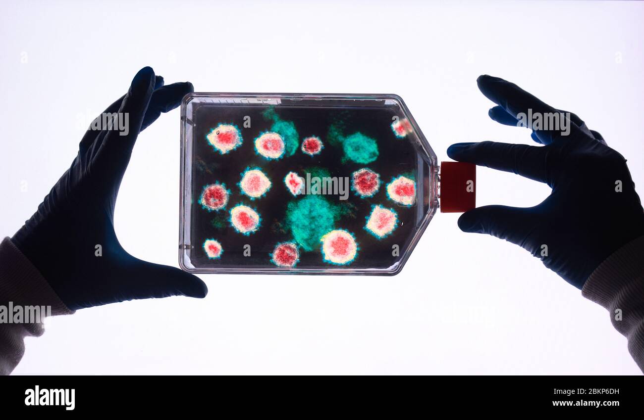 Ricerca farmaceutica su malattie e pandemie. Scienziato che tiene un vaso cellulare con un microscopio elettronico immagine di un virus all'interno. Foto Stock
