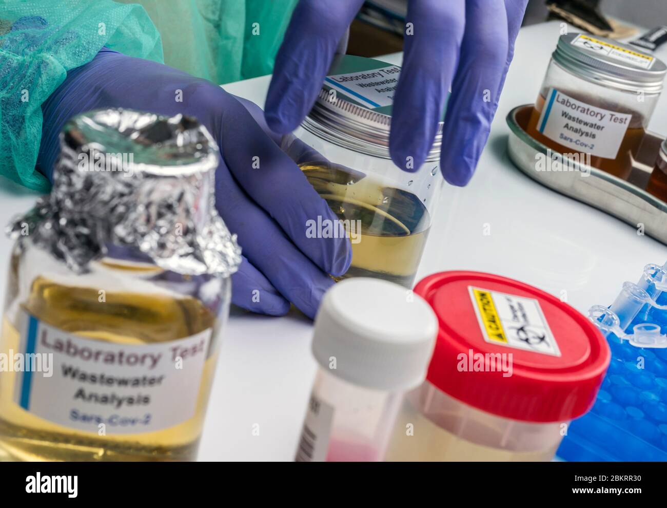 Analisi scientifica del campione di acque reflue in laboratorio, indagine di possibile contaminazione da parte di Sars-Cov-2 nell'uomo, immagine concettuale Foto Stock