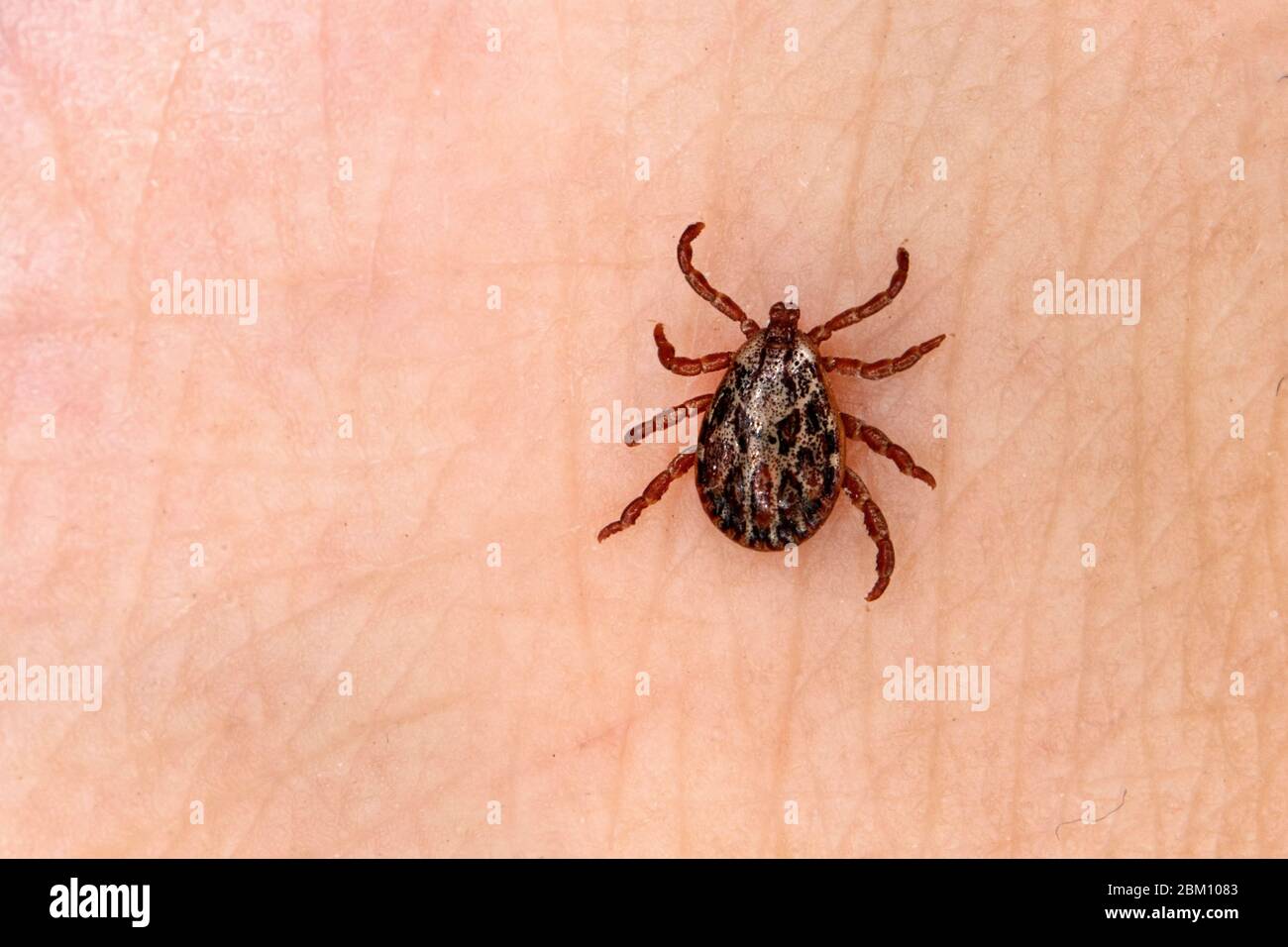 Un insetto pericoloso che succhia il sangue. Acaro macinato bruno piccolo, nome biologico Dermacentor marginatus sulla pelle umana. Spunta sullo sfondo della pelle. Macroph Foto Stock