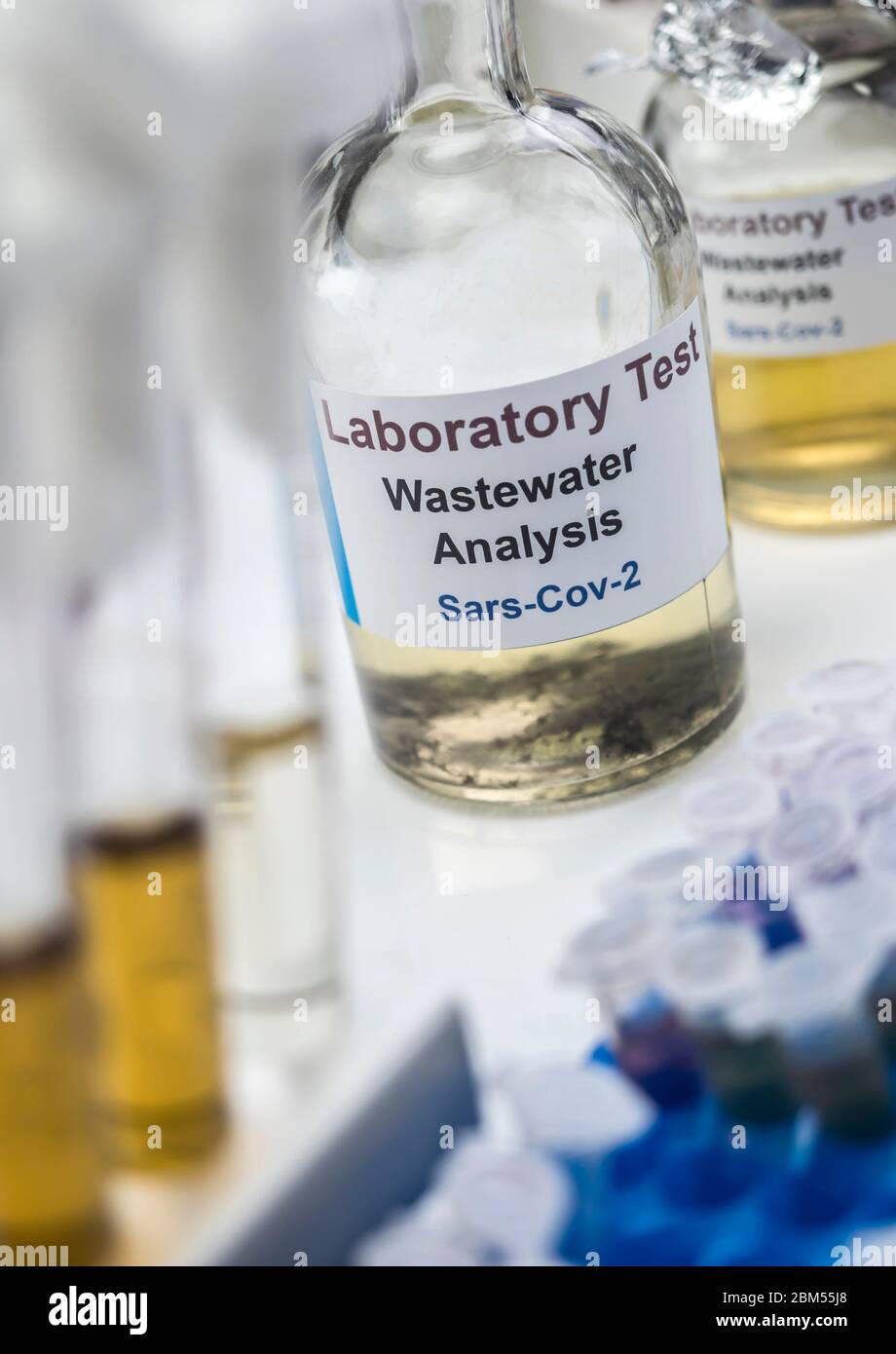 Campioni di acque reflue, analisi del virus sars-cov-2 in pazienti infettati da coronavirus umano 229E, immagine concettuale Foto Stock