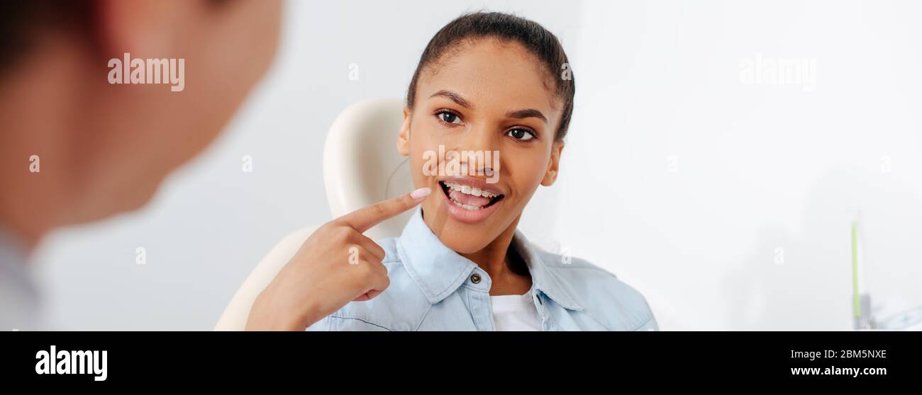 colpo panoramico di donna african american con bocca aperta che punta con il dito alle parentesi graffe vicino ortodontista in clinica Foto Stock