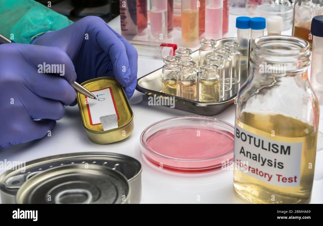 Uno scienziato di laboratorio esperto scrive su un'etichetta di cibo in scatola per analizzare l'infezione botulistica in persone malate, immagine concettuale Foto Stock