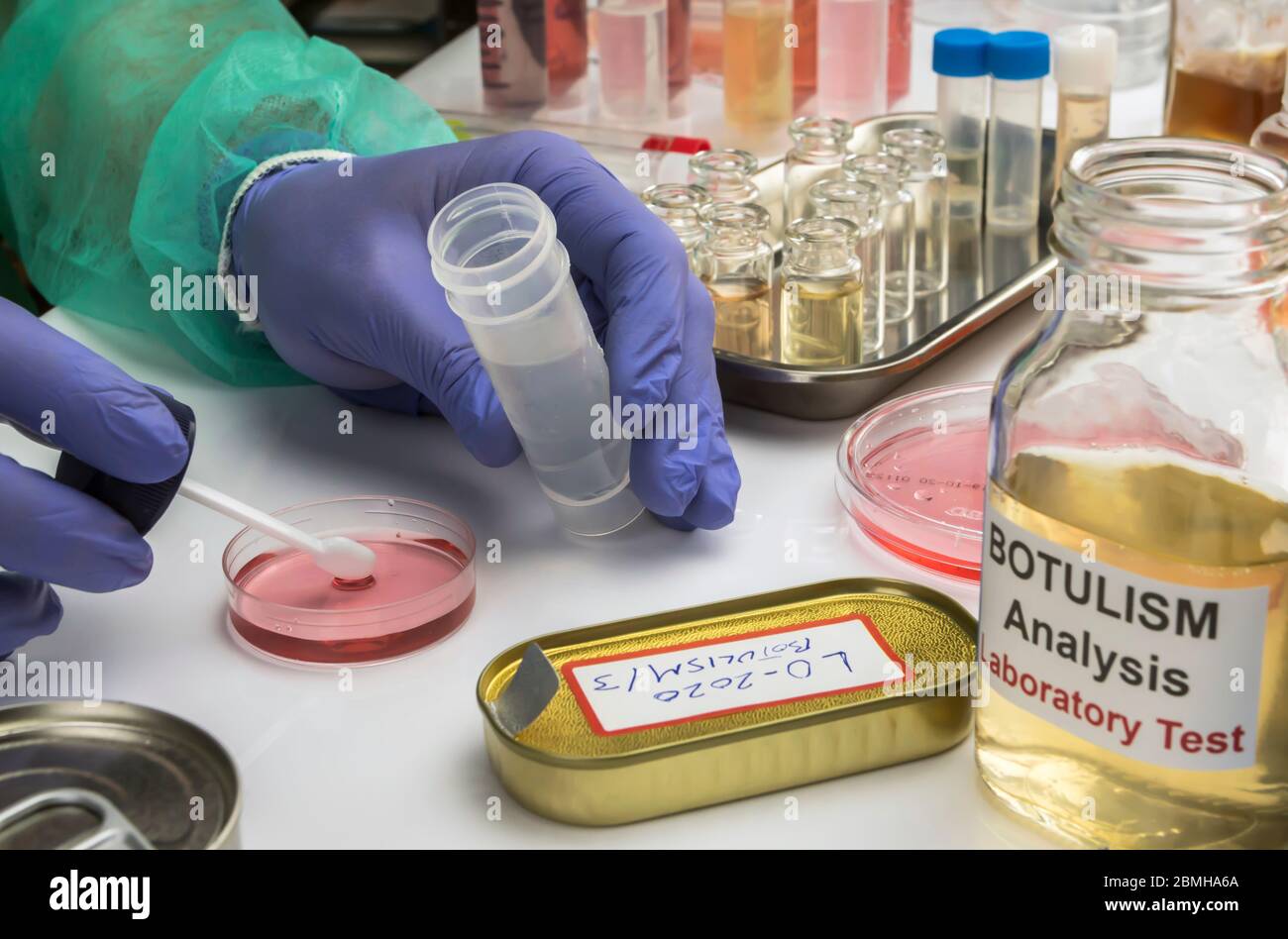 Scienziato di laboratorio esperto che analizza un campione da un cibo in scatola può, infezione botulistica in persone ammalate, immagine concettuale Foto Stock