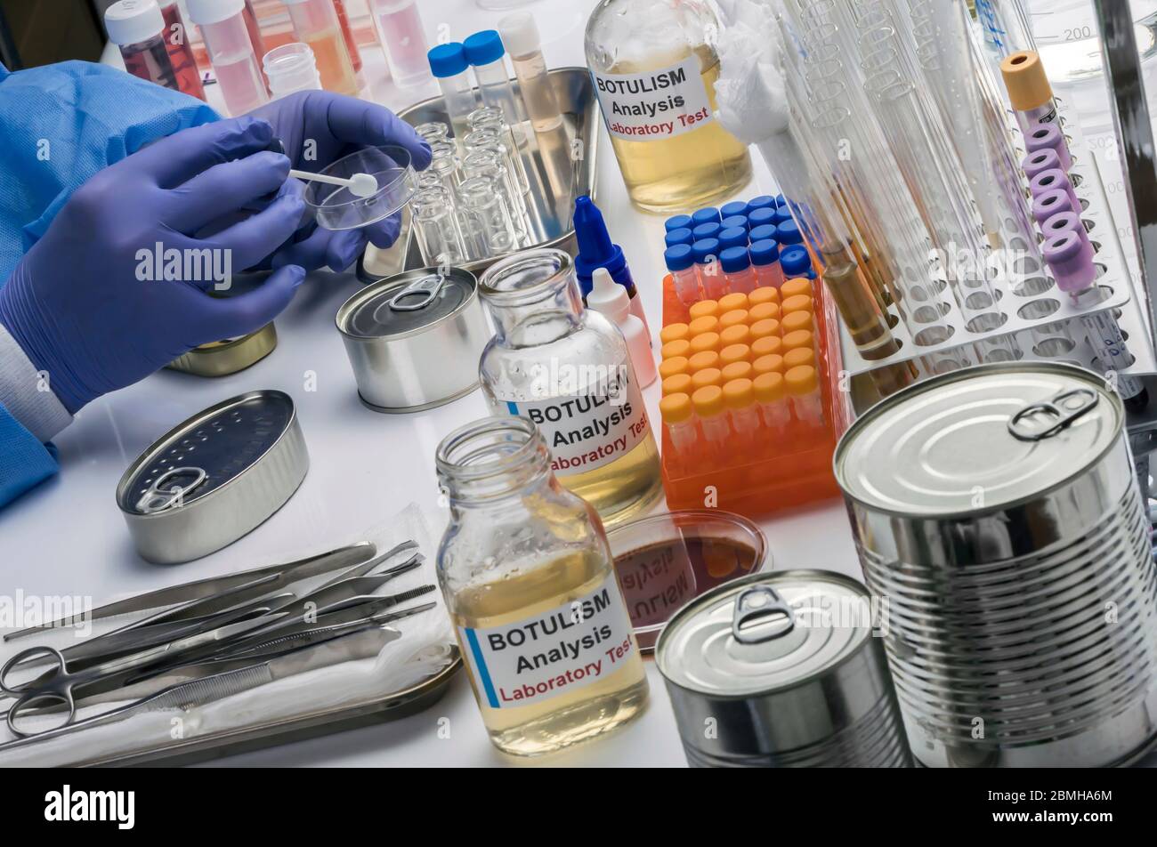Specialista analizza il botulismo campioni in laboratorio, immagine concettuale Foto Stock