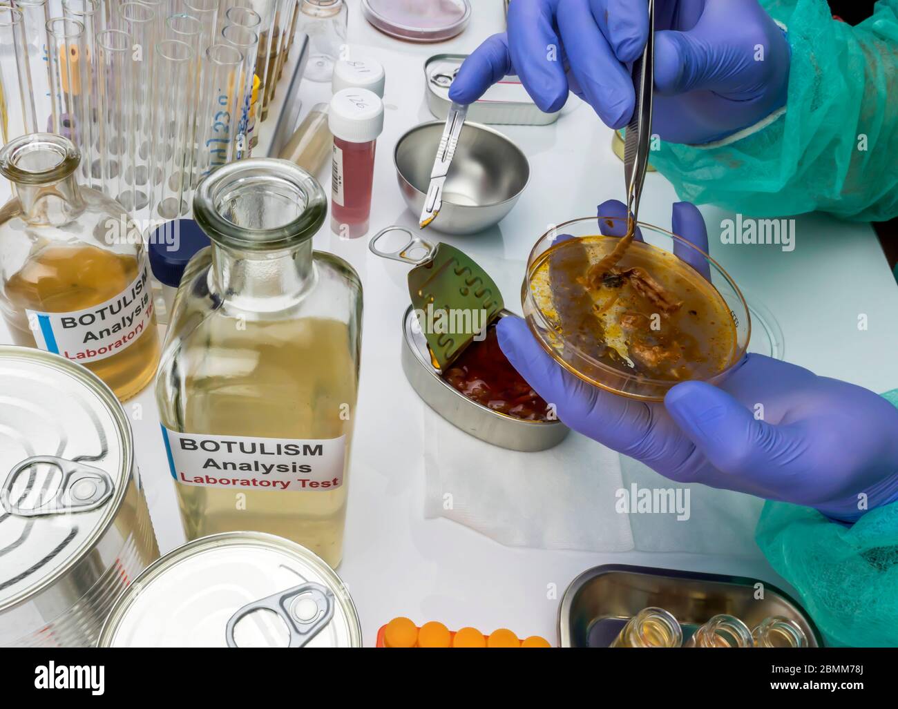Scienziato di laboratorio esperto che analizza un campione da un cibo in scatola può, infezione botulistica in persone ammalate, immagine concettuale Foto Stock