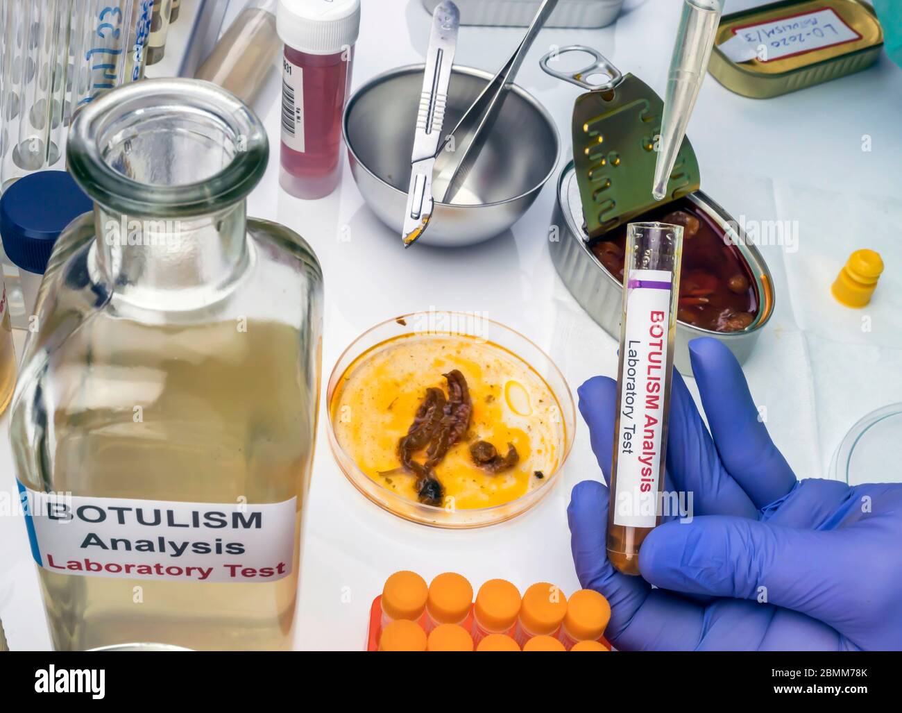 Scienziato di laboratorio esperto che analizza un campione da un cibo in scatola può, infezione botulistica in persone ammalate, immagine concettuale Foto Stock