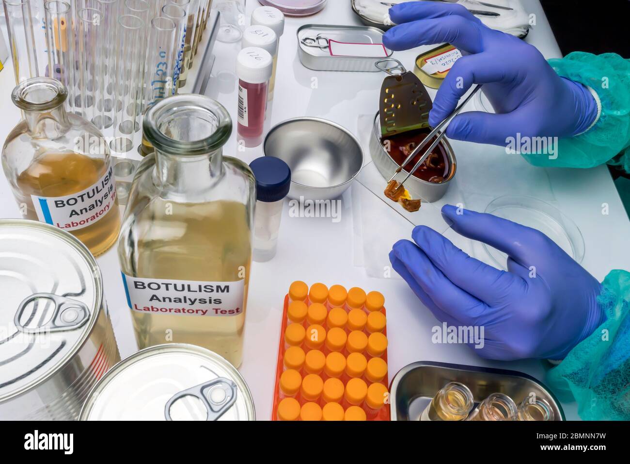 Scienziato di laboratorio esperto che analizza un campione da un cibo in scatola può, infezione botulistica in persone ammalate, immagine concettuale Foto Stock