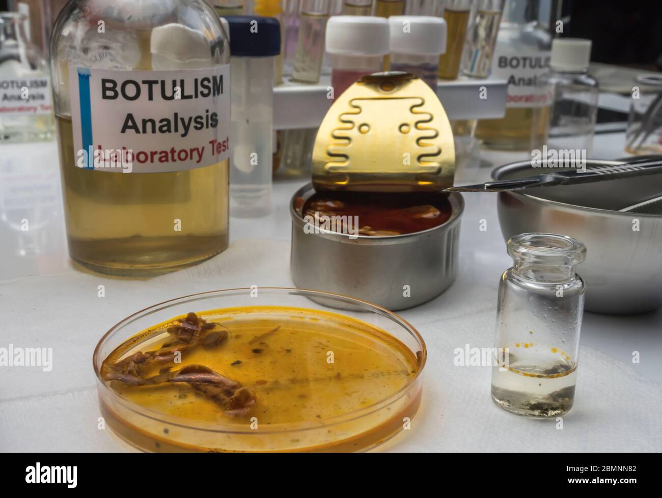 campione di lattine di stagno, infezione botulistica in persone ammalate, immagine concettuale Foto Stock