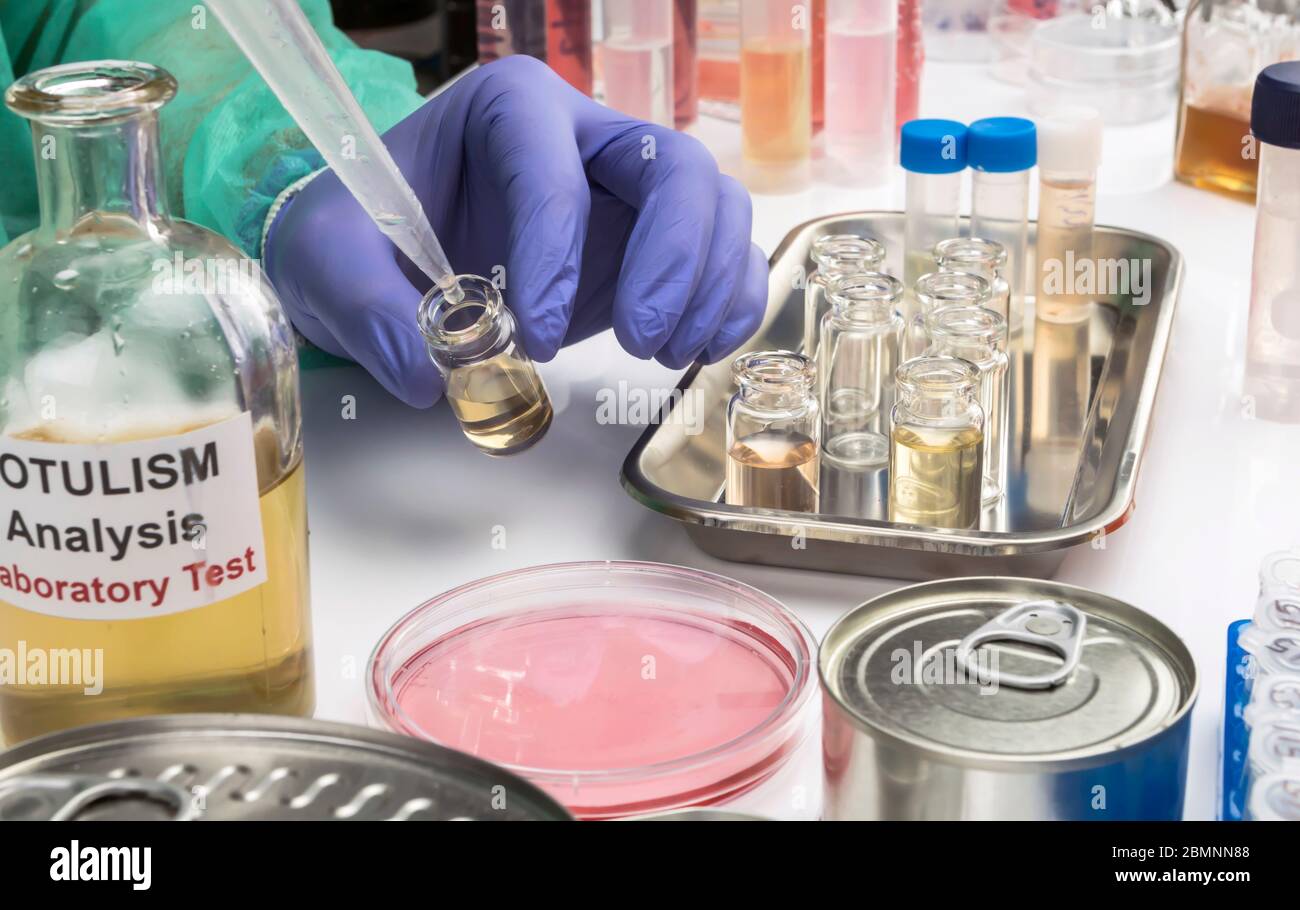 Scienziato di laboratorio esperto che analizza un campione da un cibo in scatola può, infezione botulistica in persone ammalate, immagine concettuale Foto Stock