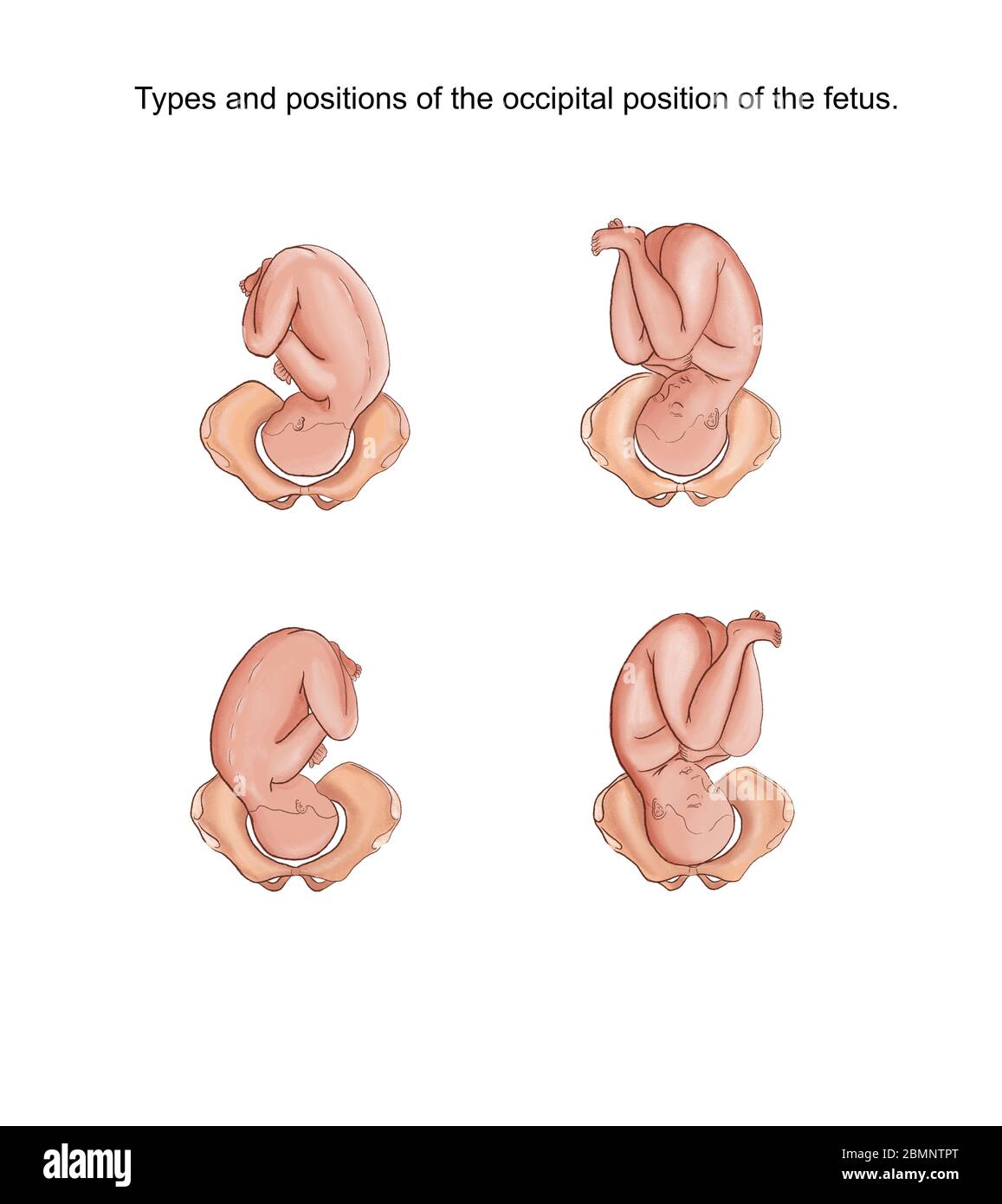 Illustrazione dei tipi e delle posizioni della posizione occipitale del feto Foto Stock