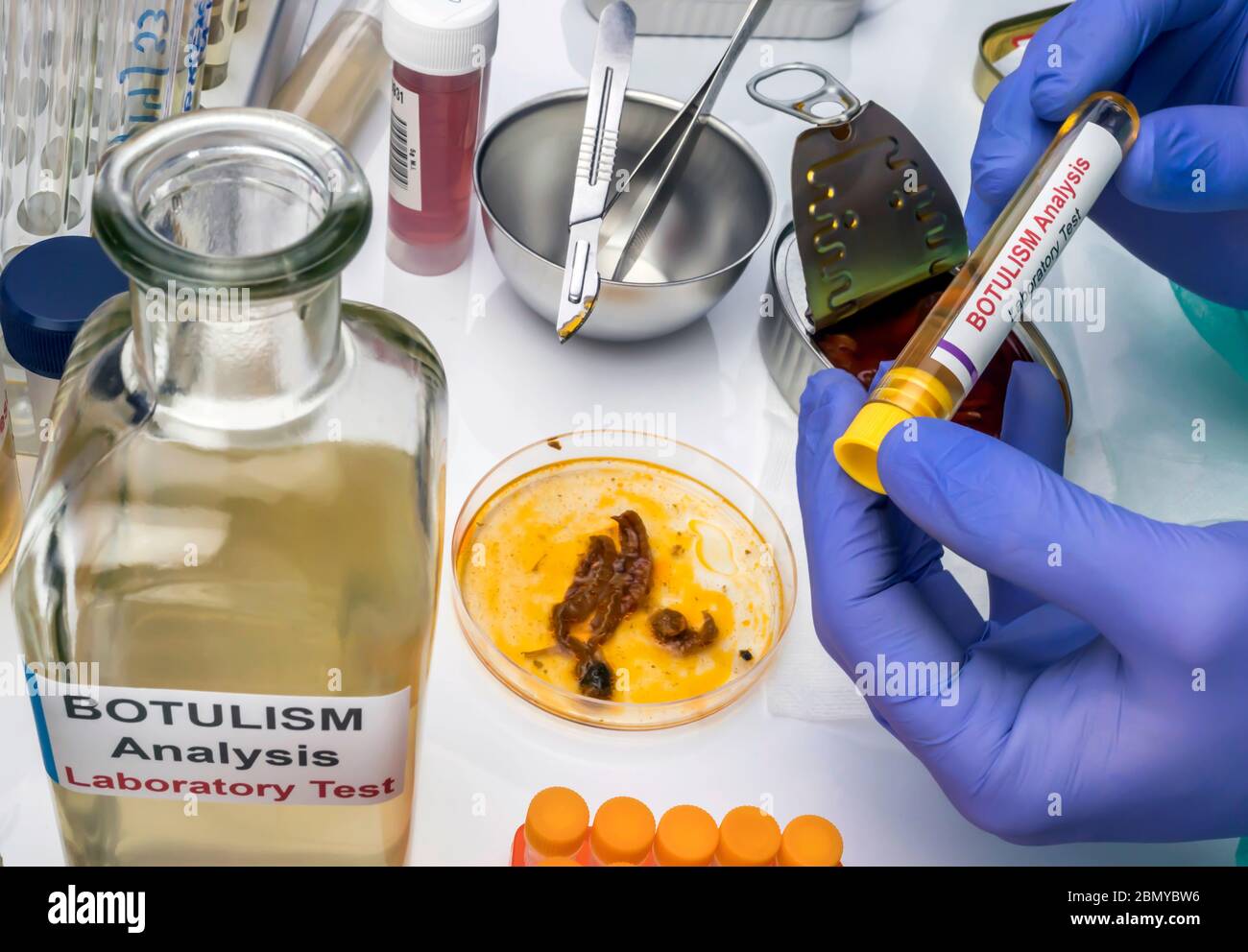 Scienziato di laboratorio esperto che analizza un campione da un cibo in scatola può, infezione botulistica in persone ammalate, immagine concettuale Foto Stock