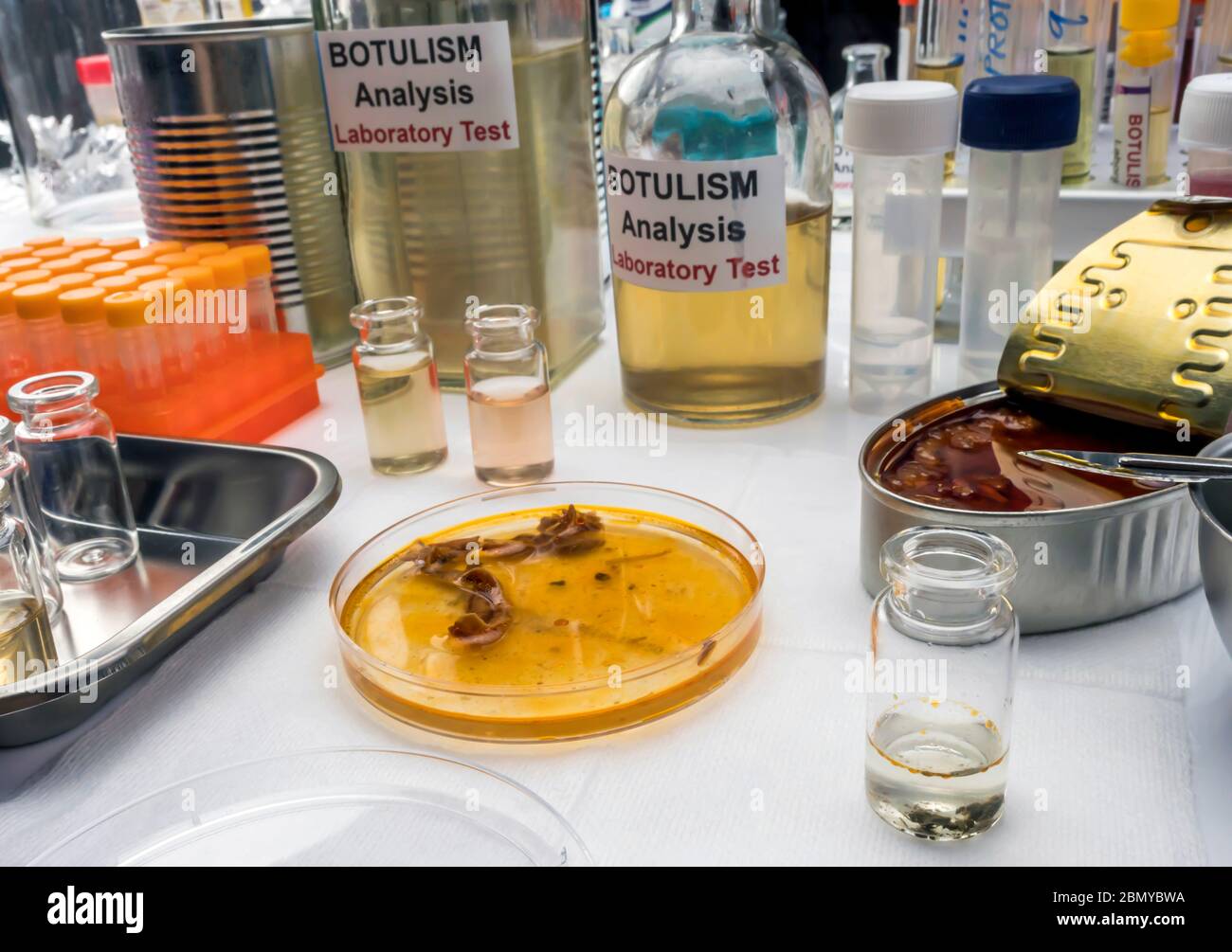 Scienziato di laboratorio esperto che analizza un campione da un cibo in scatola può, infezione botulistica in persone ammalate, immagine concettuale Foto Stock