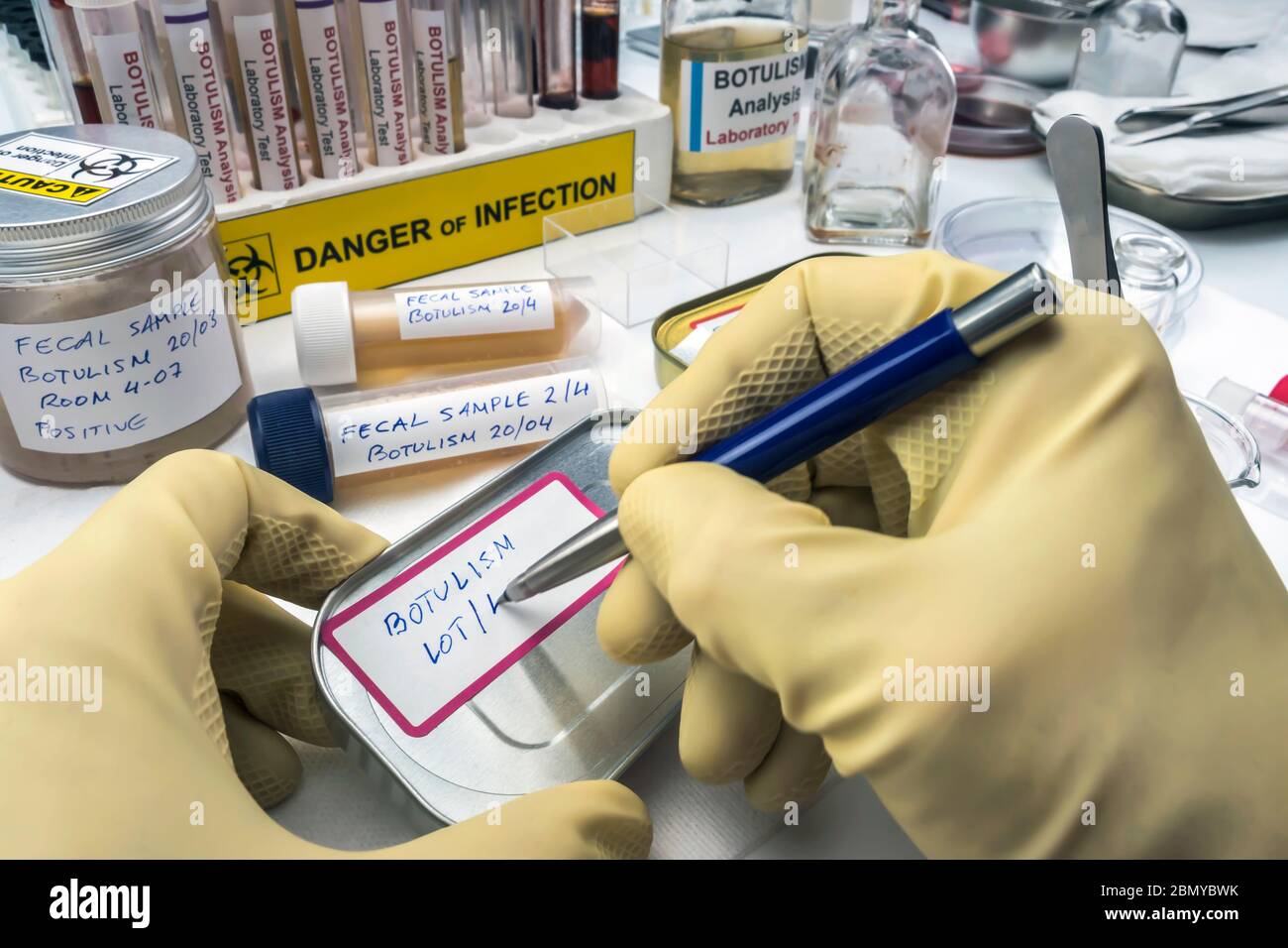 Lo scienziato specializzato scrive sull'etichetta di un alimento inscatolato infetto, infezione botulistica in gente malata, immagine concettuale Foto Stock