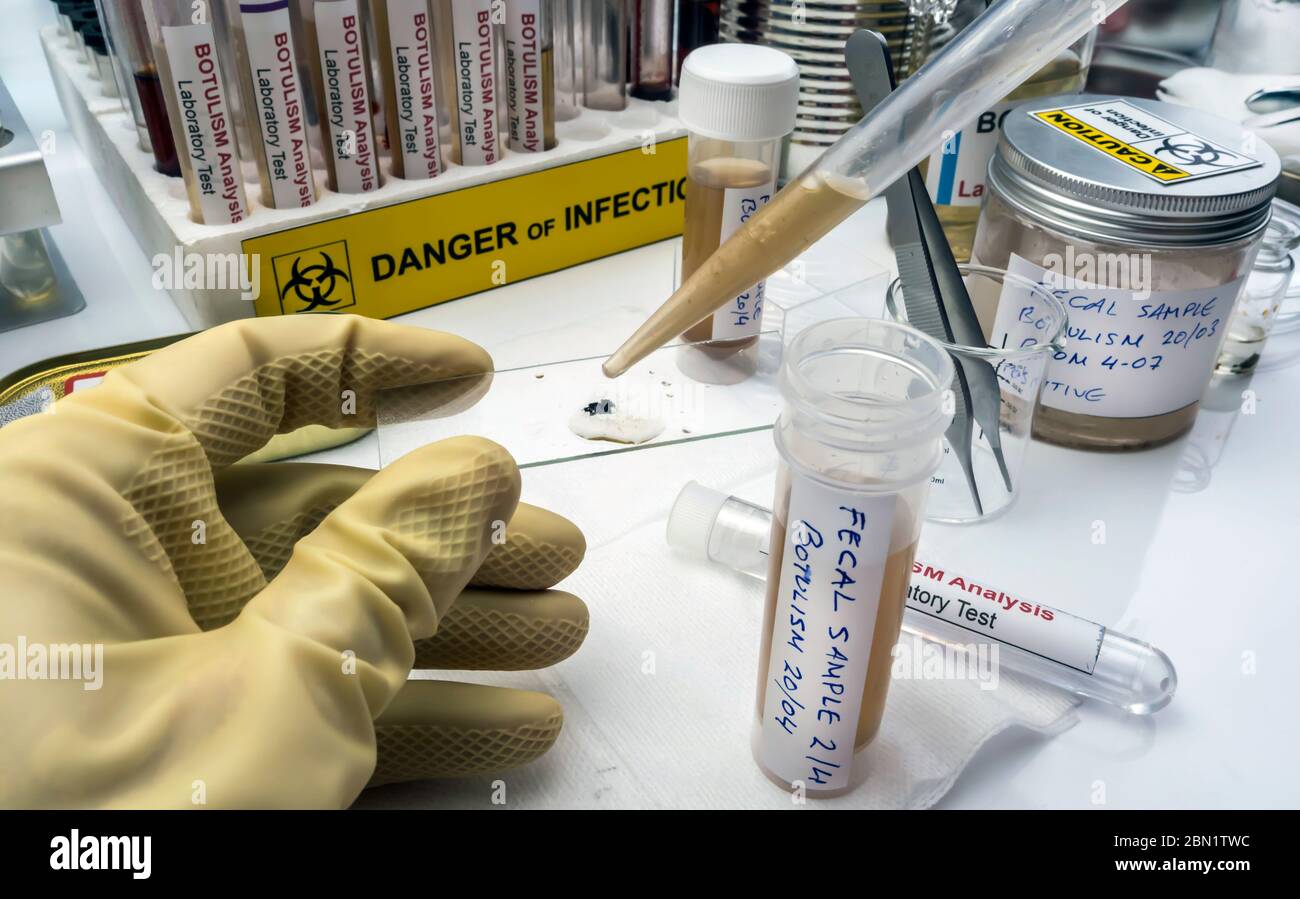 Esperto scienziato di laboratorio che analizza un campione fecale, infezione botulistica in persone ammalate, immagine concettuale Foto Stock