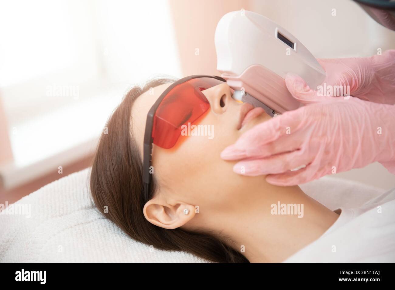 Rimozione di capelli indesiderati laser sul viso baffi donna giovane. Bellezza e salute del concetto Foto Stock