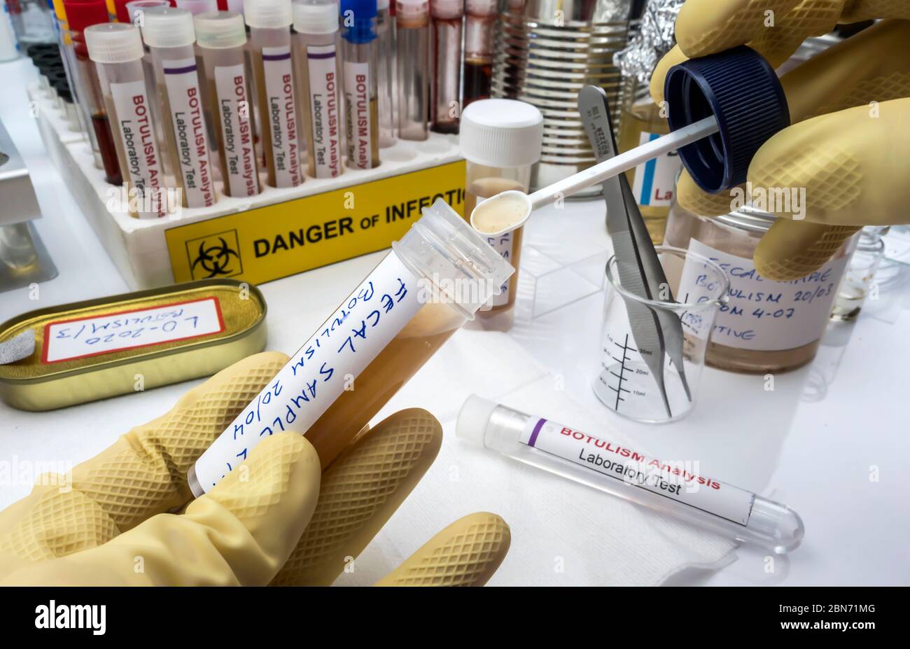 Esperto scienziato di laboratorio che analizza un campione fecale, infezione botulistica in persone ammalate, immagine concettuale Foto Stock