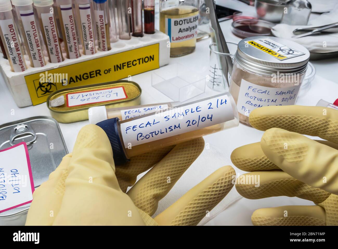 Esperto scienziato di laboratorio che analizza un campione fecale, infezione botulistica in persone ammalate, immagine concettuale Foto Stock