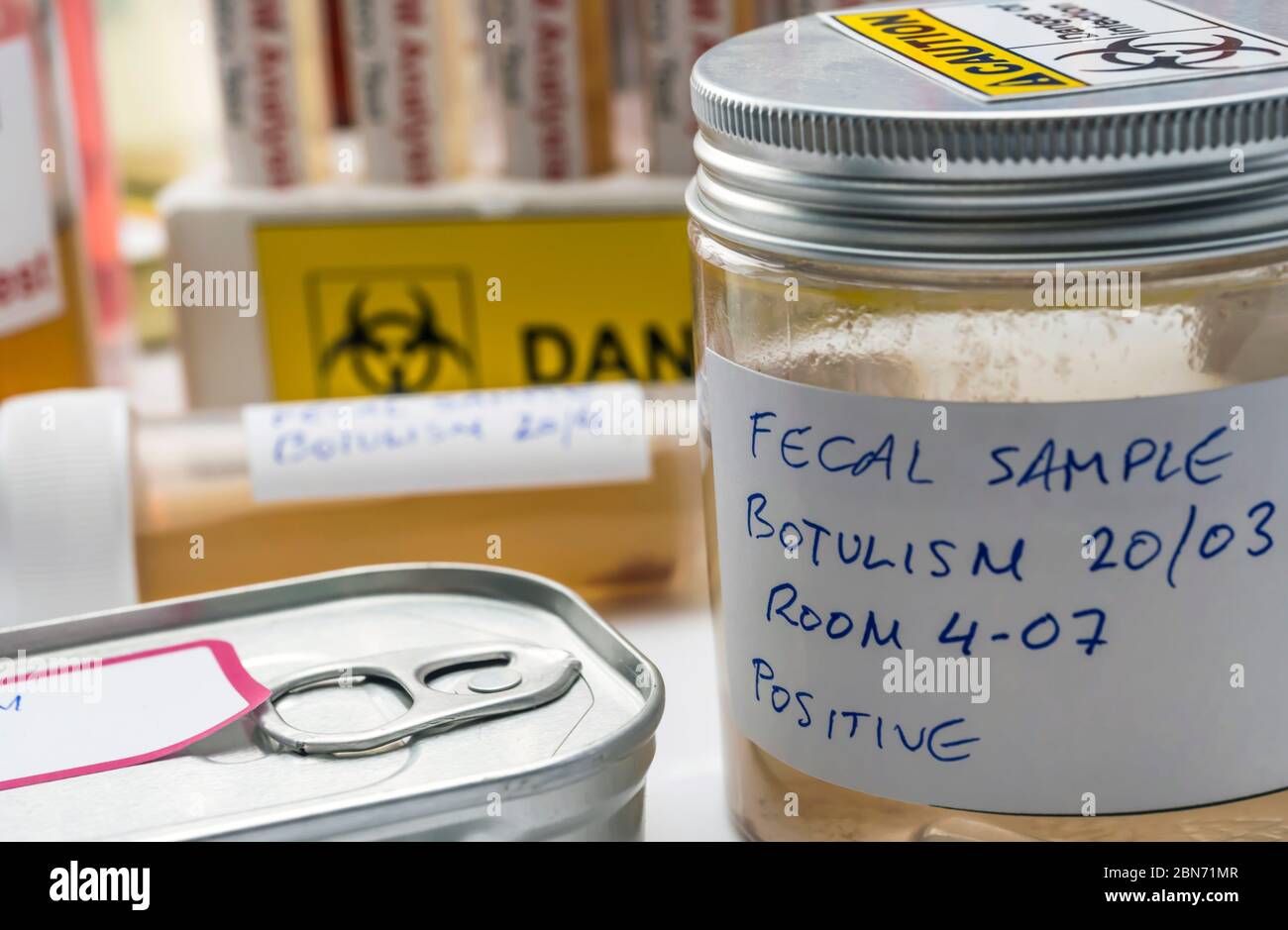 Campione fecale di una persona infetta da botulismo, infezione in lattine in cattive condizioni, immagine concettuale Foto Stock