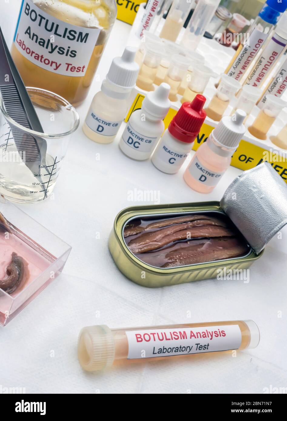 Il cibo in scatola può essere contaminato dalla tossina botulinica Clostridium che causa botulismo negli esseri umani, ricerca di laboratorio, immagine concettuale Foto Stock