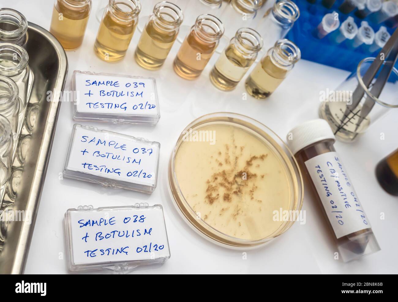 Campioni contaminati dalla tossina botulinica Clostridium che causa botulismo nell'uomo, ricerca di laboratorio, immagine concettuale Foto Stock