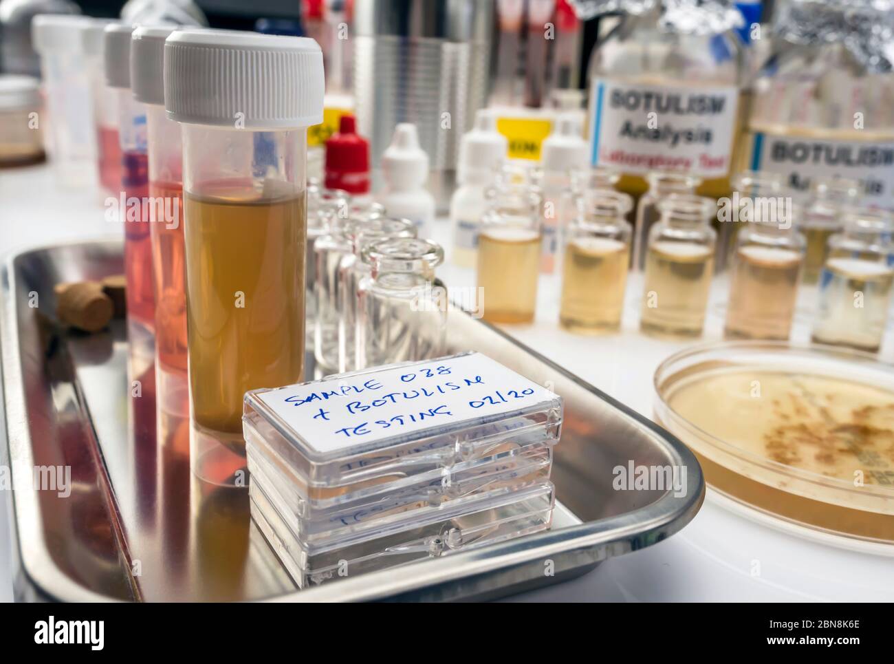 Campioni contaminati dalla tossina botulinica Clostridium che causa botulismo nell'uomo, ricerca di laboratorio, immagine concettuale Foto Stock