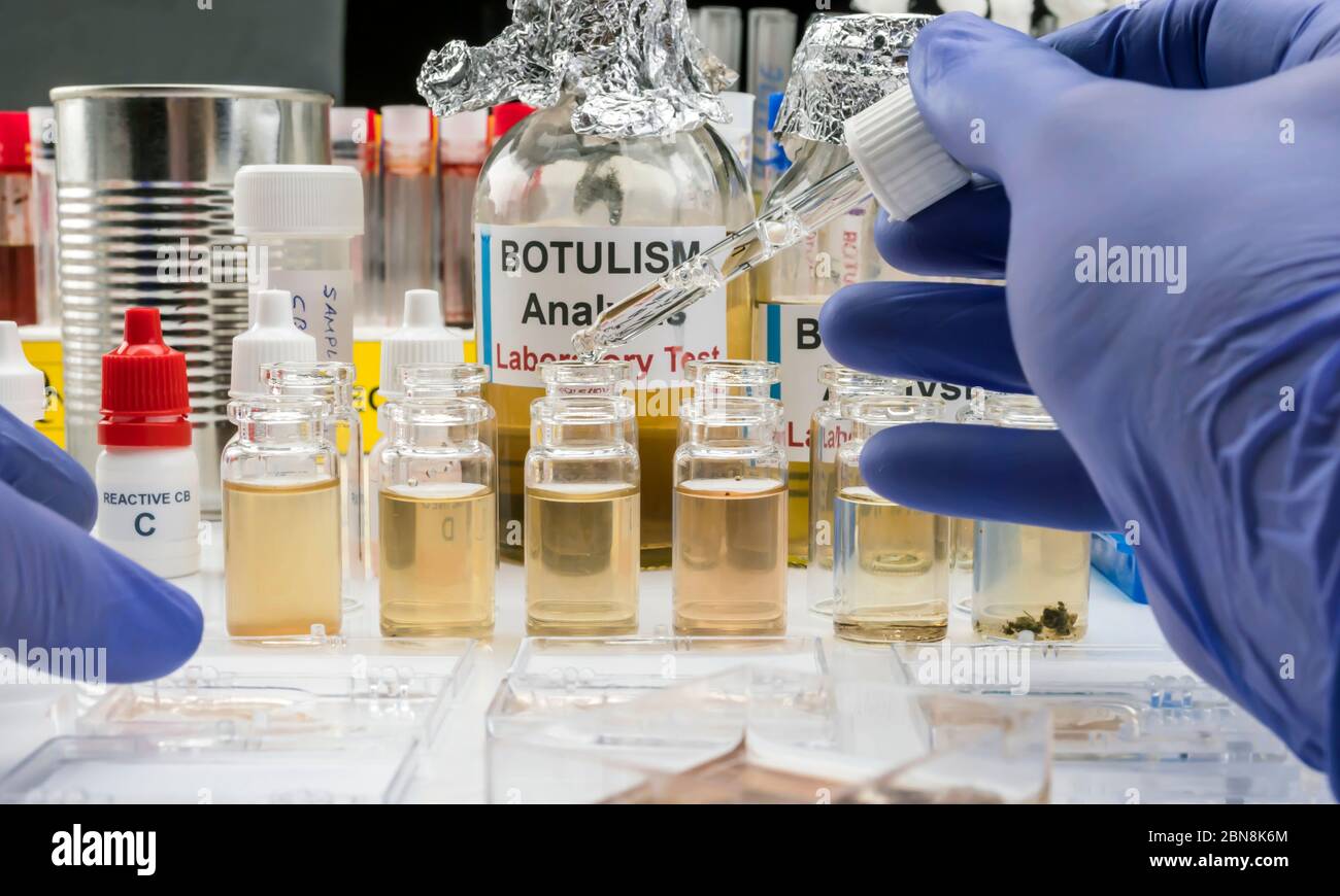 Scienziato di laboratorio esperto che analizza un campione da un cibo in scatola può, infezione botulistica in persone ammalate, immagine concettuale Foto Stock
