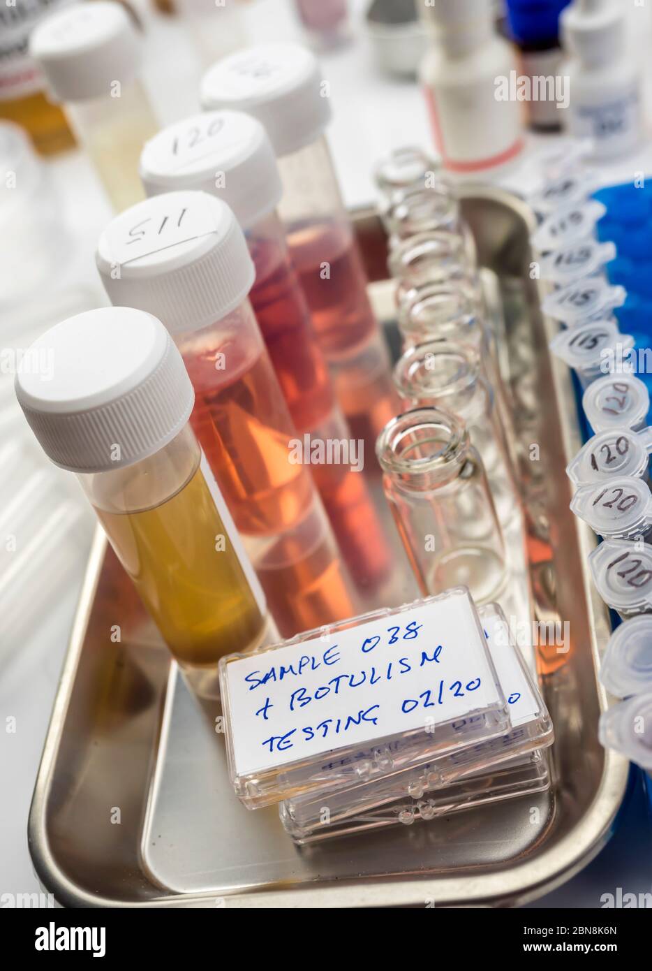 Campioni contaminati dalla tossina botulinica Clostridium che causa botulismo nell'uomo, ricerca di laboratorio, immagine concettuale Foto Stock