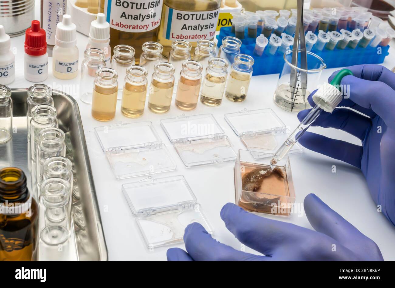 Esperto scienziato di laboratorio che analizza un campione da una lattina di cibo in scatola, infezione botulismo in persone malate Foto Stock
