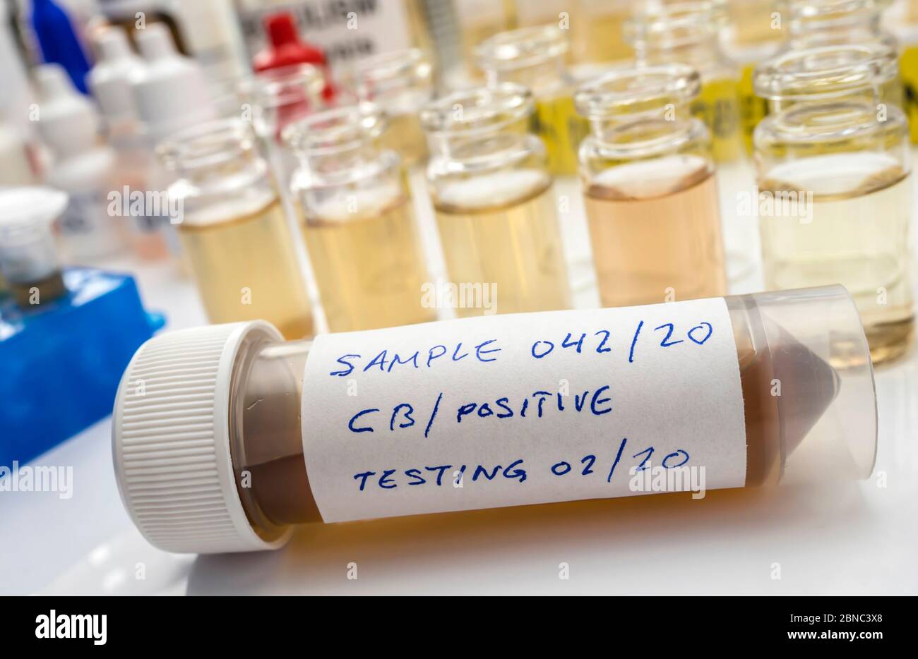 Campioni contaminati dalla tossina botulinica Clostridium che causa botulismo nell'uomo, ricerca di laboratorio, immagine concettuale Foto Stock