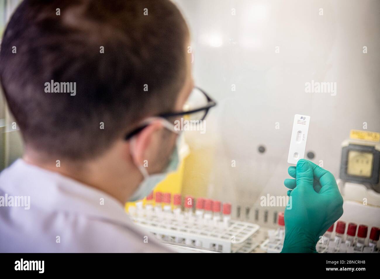 COVID-19 laboratorio di analisi sierologiche per individui, microbiologia e virologia del PST - Polo Scientifico e tecnologico, Gruppo MultiMedica. In laboratorio vengono analizzati fino a 400 test al giorno per confermare la presenza di anticorpi nel sangue. Una tessera di un paziente che prova gli anticorpi IGG positivi (Marco Passaro/Fotogramma, - 2020-05-14) p.s. la foto e' utilizzabile nel messaggio del contenuto in cui e' stata sbattata, e senza intesa diffusatorio del decoro delle persone rappresentate Foto Stock