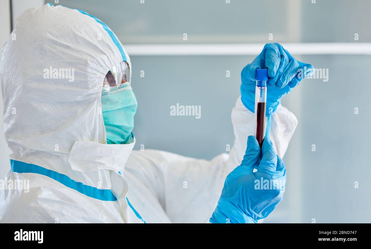 Lo scienziato del laboratorio esamina il campionamento del sangue durante la pandemia di Coronavirus e Covid 19 Foto Stock