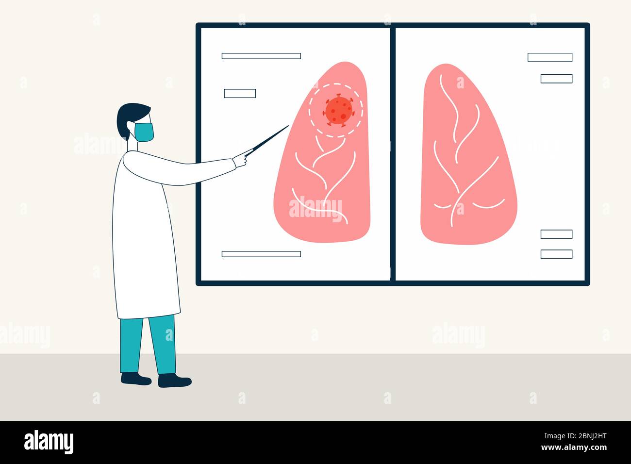 Un medico in un uniforme e una maschera medica punta a un sito di infiammazione su un radiografia dei polmoni. Polmonite virale Illustrazione Vettoriale