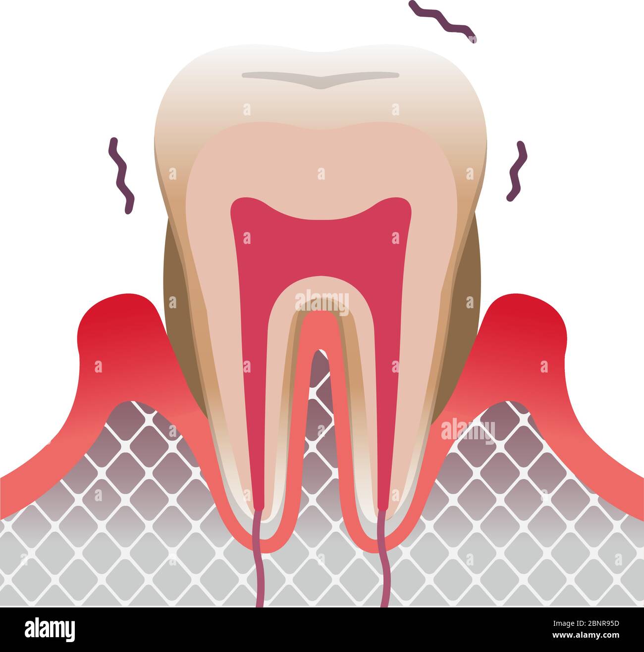 malattia parodontale illustrazione vettoriale piatta dei denti e delle gengive Illustrazione Vettoriale