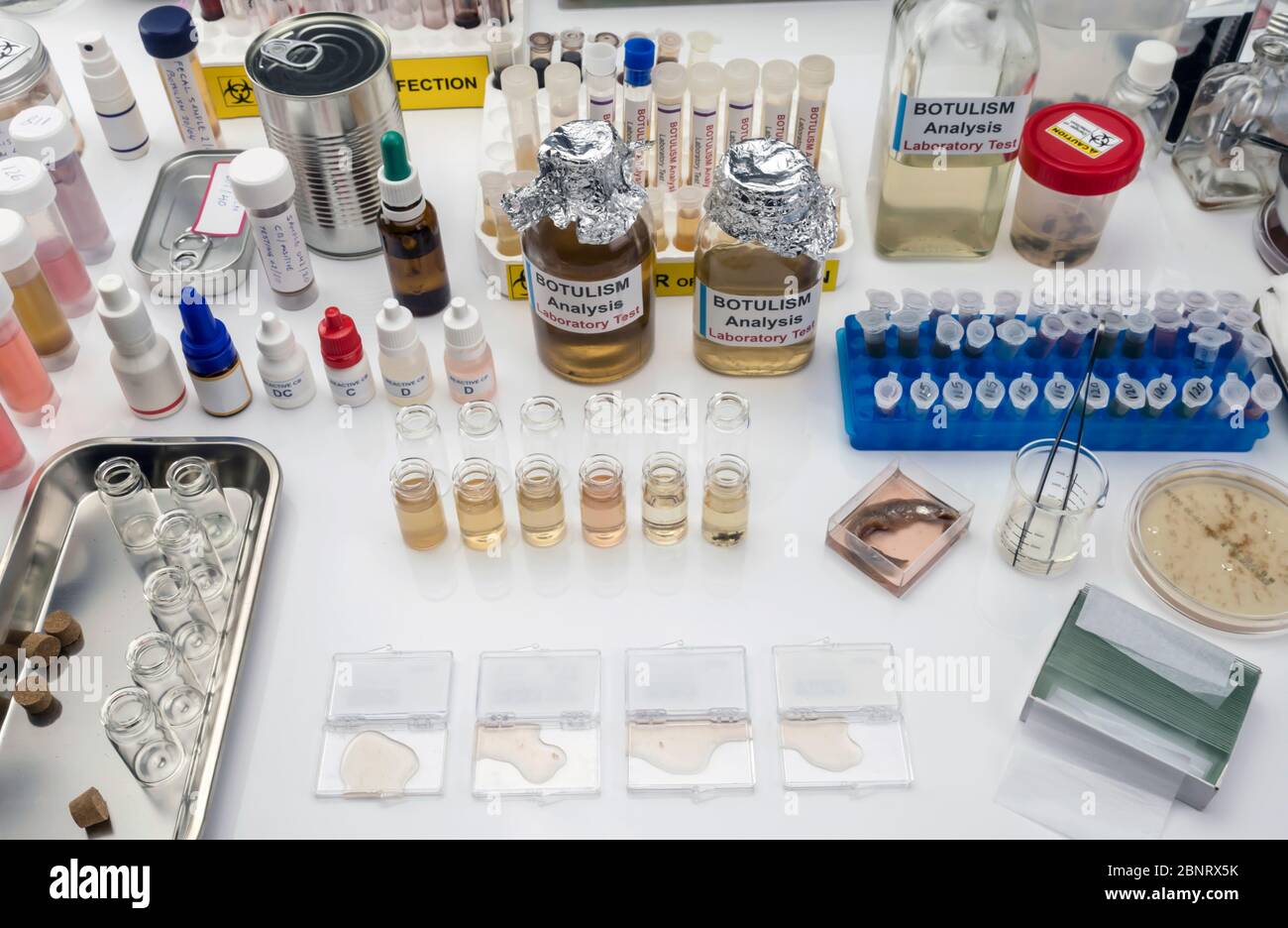 Campioni contaminati dalla tossina botulinica Clostridium che causa botulismo nell'uomo, ricerca di laboratorio, immagine concettuale Foto Stock