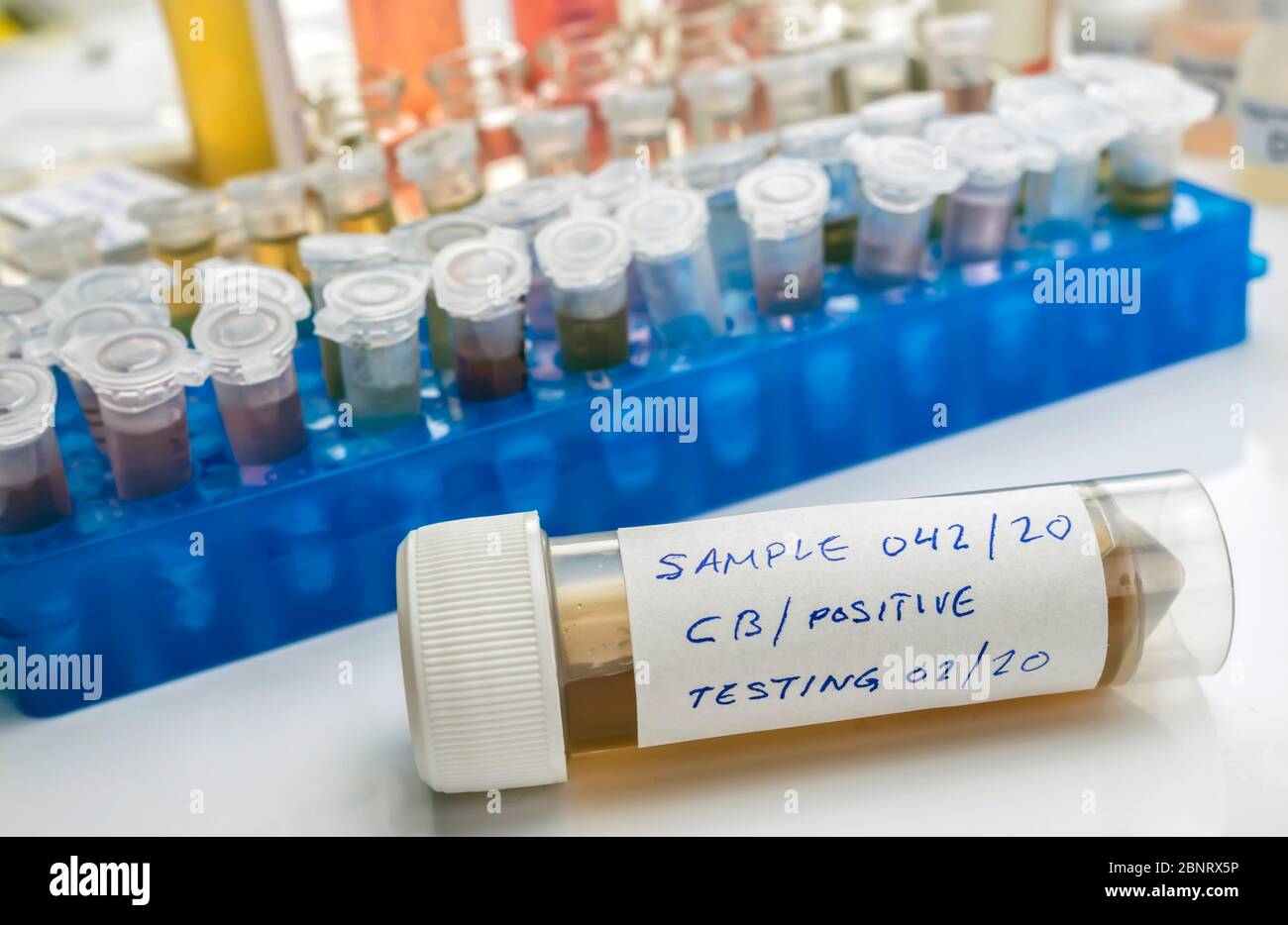 Campioni contaminati dalla tossina botulinica Clostridium che causa botulismo nell'uomo, ricerca di laboratorio, immagine concettuale Foto Stock