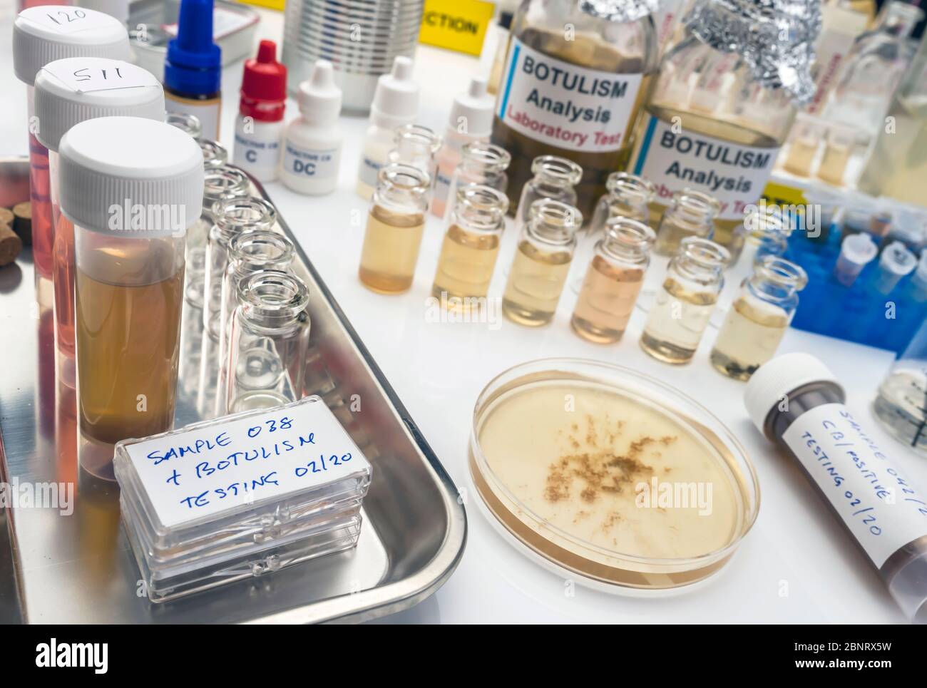 Campioni contaminati dalla tossina botulinica Clostridium che causa botulismo nell'uomo, ricerca di laboratorio, immagine concettuale Foto Stock