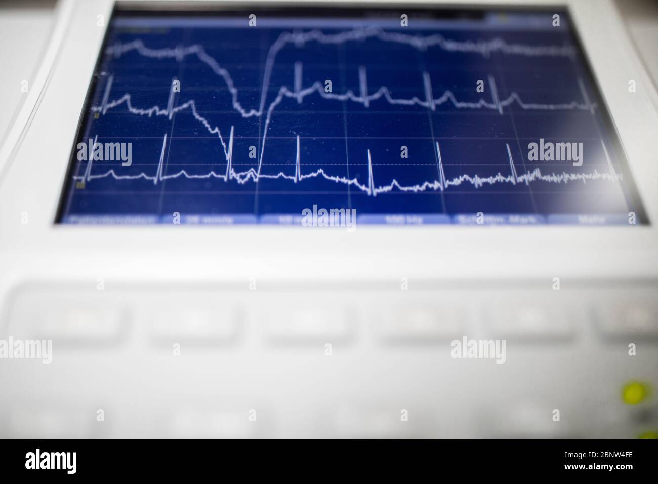 Macchina EKG che mostra le onde della pressione sanguigna. Foto Stock