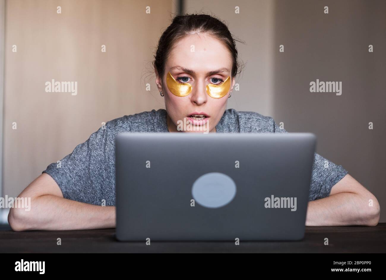 Donna scioccata con le macchie di idrogel sul viso, guardando con stupore schermo del laptop. Foto Stock