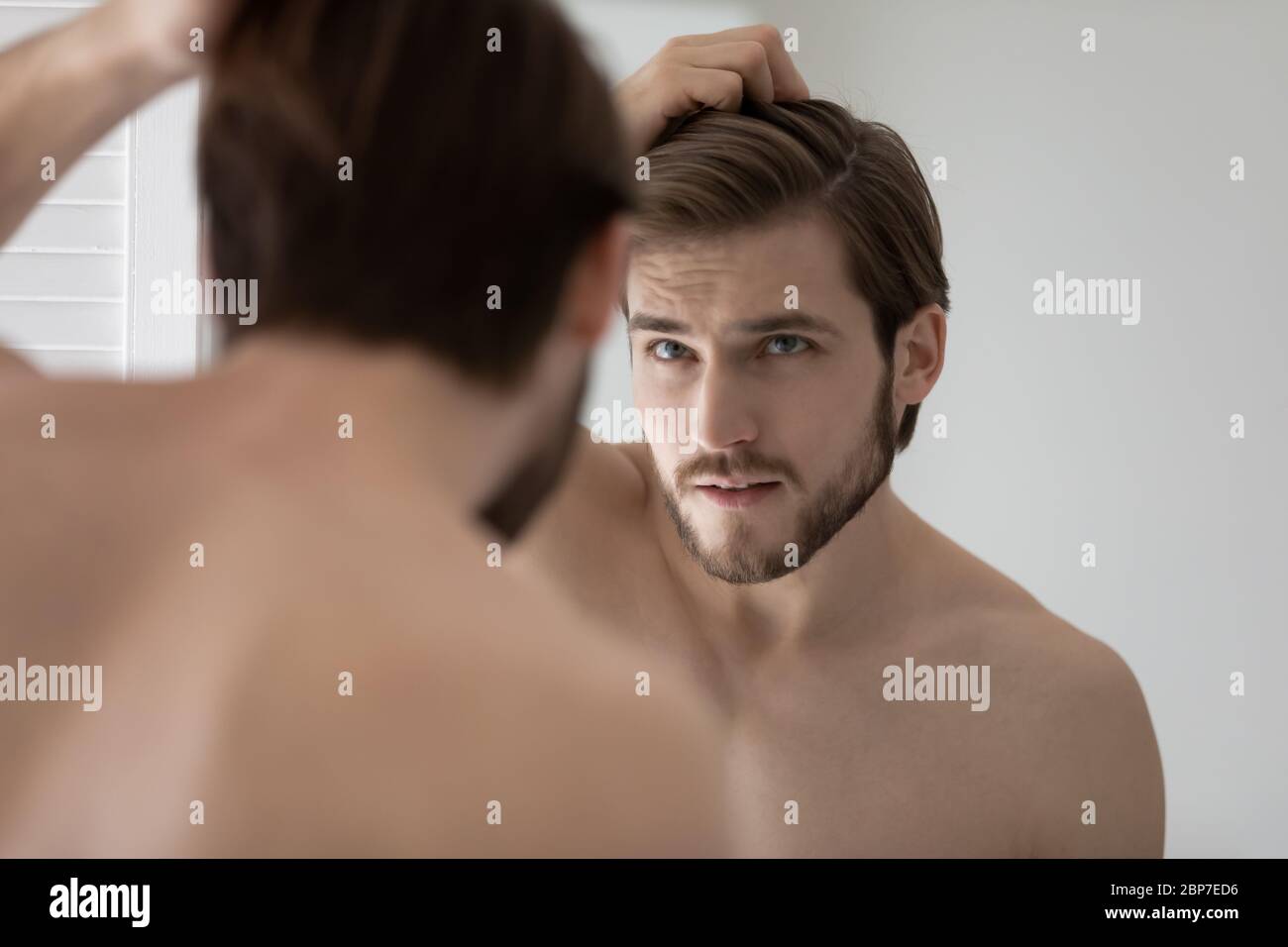 L'uomo giovane ansioso preoccupato per la perdita dei capelli o la recedendo la linea di capelli Foto Stock