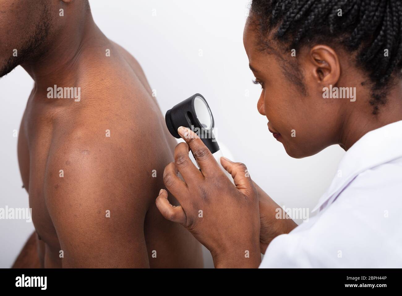 Close-up di una femmina di controllo medico di pigmento sulla pelle uomo torna con Dermatoscope Foto Stock